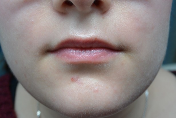 een paar uurtjes later